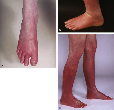pletheraoffeet .